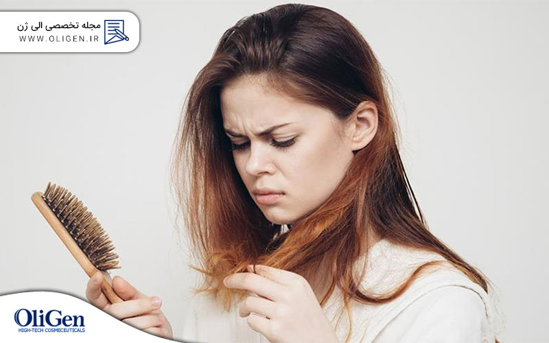 دلایل اصلی ریزش مو در خانم ها کدامند؟