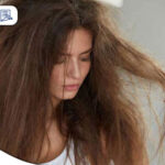 ریزش مو در اثر استرس؟ آنچه باید در مورد ریزش مو و استرس مزمن بدانید