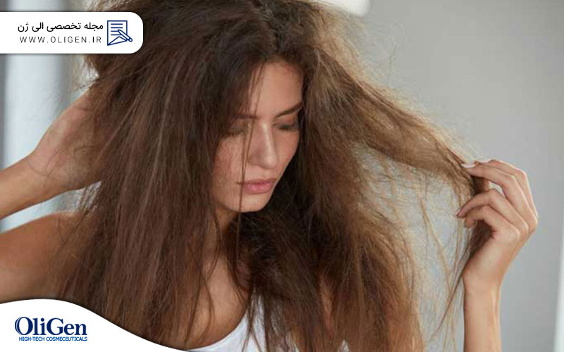 ریزش مو در اثر استرس؟ آنچه باید در مورد ریزش مو و استرس مزمن بدانید