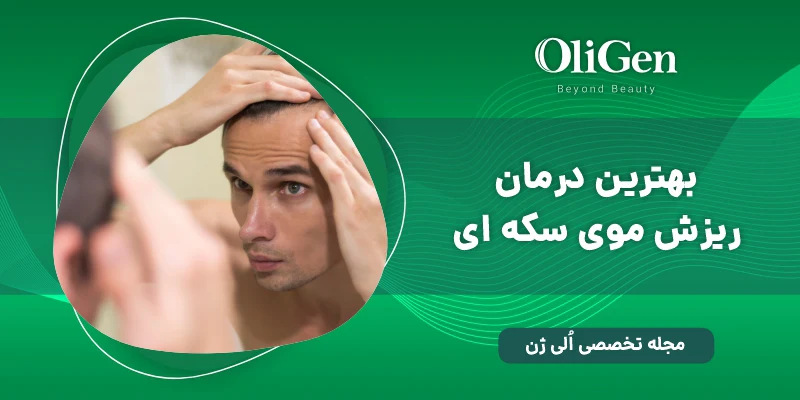 ریزش موی سکه ای درمان